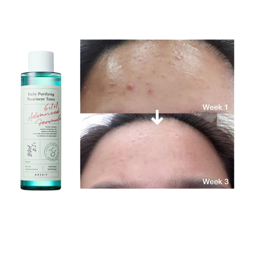 AXIS-Y Daily Purifying Treatment Toner