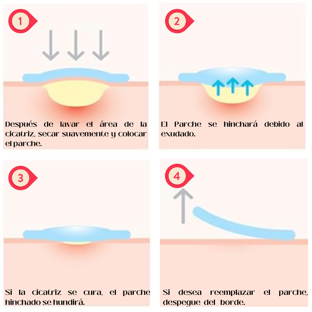 SOME BY MI Clear Spot Patch